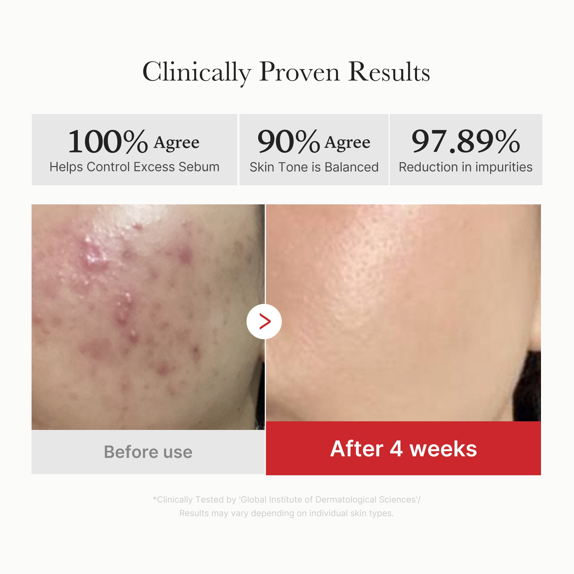 Medicube Red Succinic Acid Pads