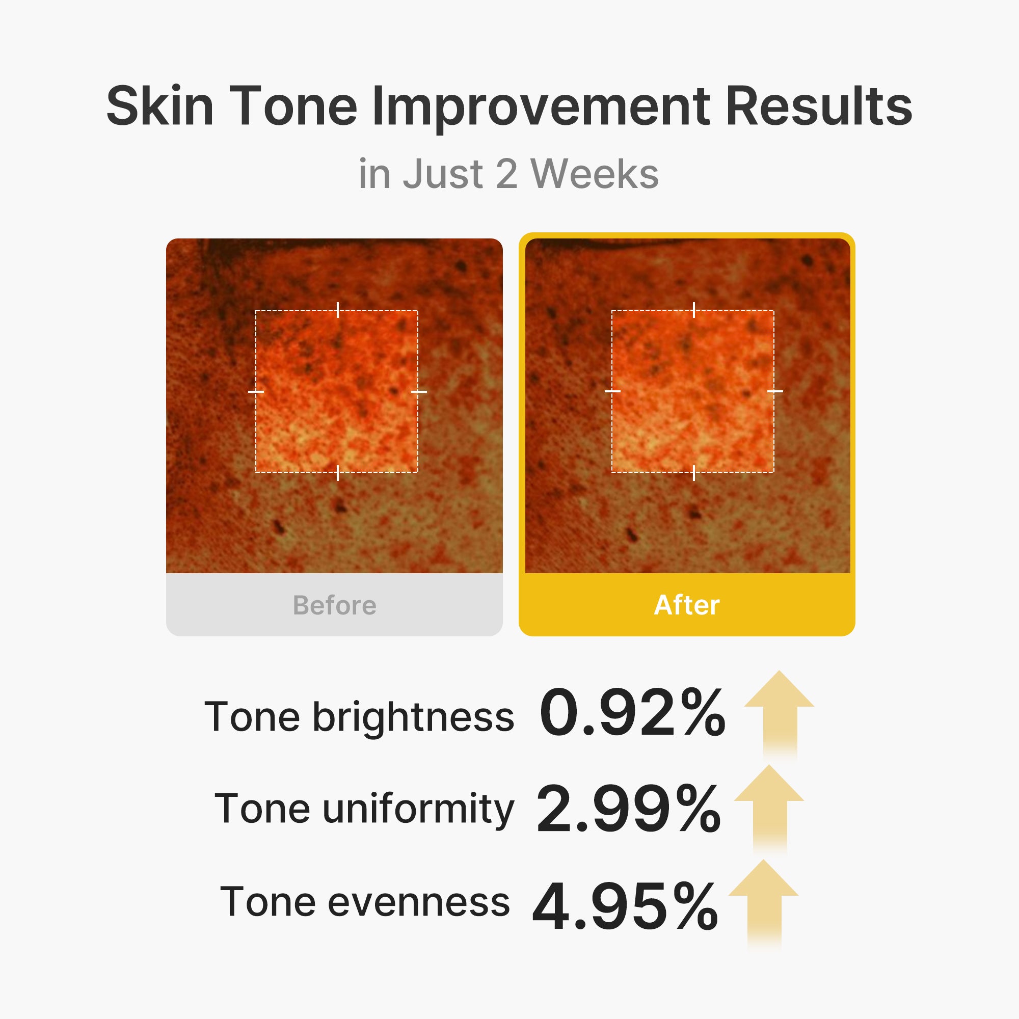 Medicube Kojic Acid Turmeric Vita Capsule Cream – Brightening Face Moisturizer for Dark Spots, Uneven Tone & Radiant Skin