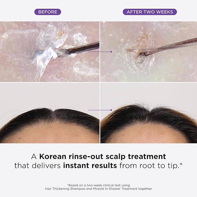 Dr. Groot Miracle In-Shower Moisturizing Treatment for Hair Loss Korean Rosemary Oil Scalp Care Rinse Fast 5 Second Repair