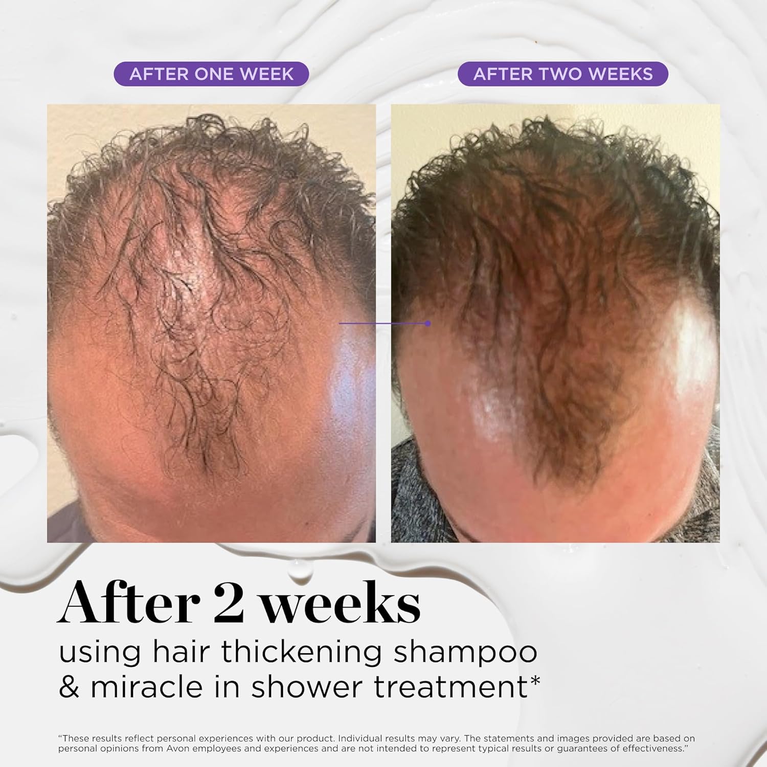 Dr. Groot Miracle In-Shower Moisturizing Treatment for Hair Loss Korean Rosemary Oil Scalp Care Rinse Fast 5 Second Repair